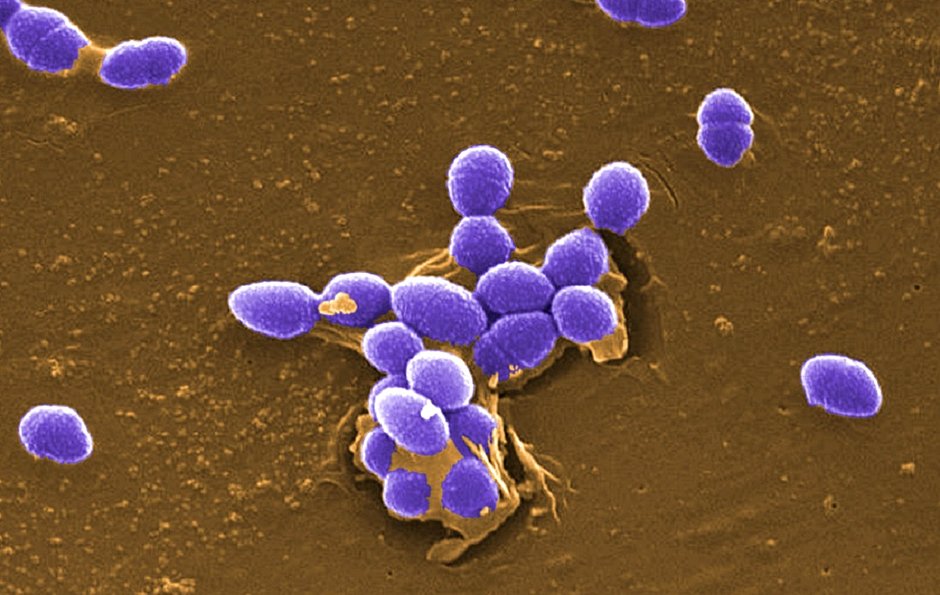 Enterococcus é a bactéria super-resistente encontrada em hospitais de Salvador (Divulgação)
