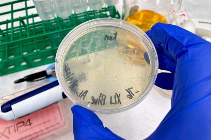 A E. coli é o principal patógeno responsável por infecções urinárias: equipe planeja ensaio com humanos - (crédito: Albert Liu)