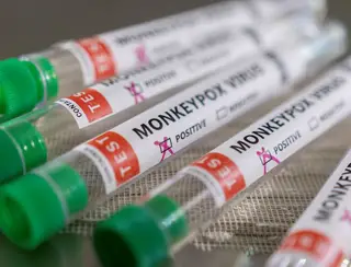 Anvisa recebe segundo pedido de registro para teste de varíola dos macacos