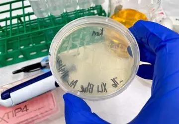 A E. coli é o principal patógeno responsável por infecções urinárias: equipe planeja ensaio com humanos - (crédito: Albert Liu)